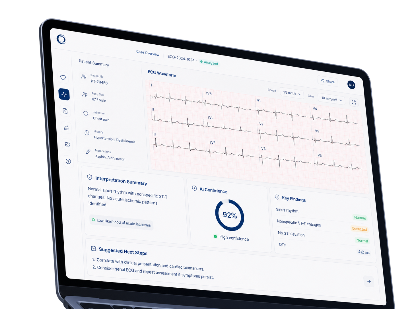 ECG Interpretation